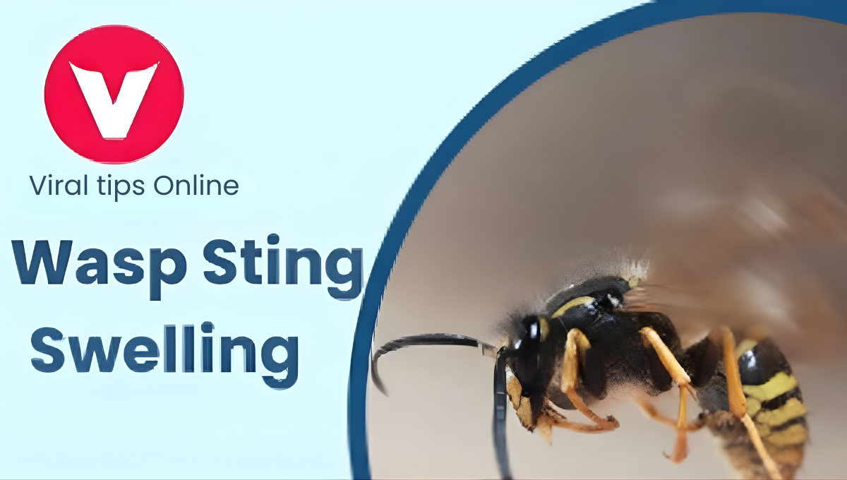 wasp sting swelling